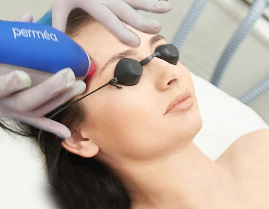 Clear + Brilliant Laser treatment on woman's forehead