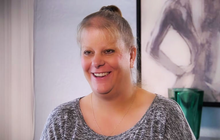 PRP Hair Restoration – Amy's Story