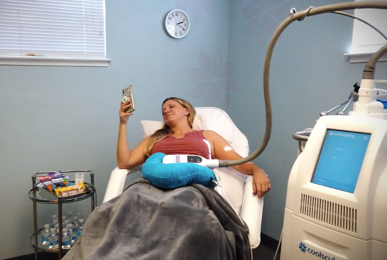 CoolSculpting® – Regan's Story