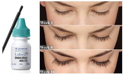 Latisse® Growth Serum Bottle next to Three Before and After Images