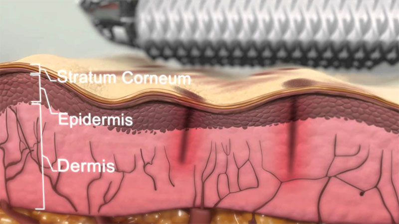 Graphic of Skin Layers