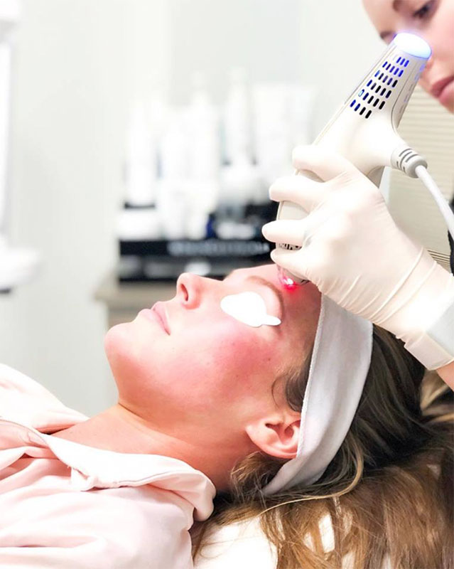 Woman receiving a Clear + Brilliant Laser Treatment
