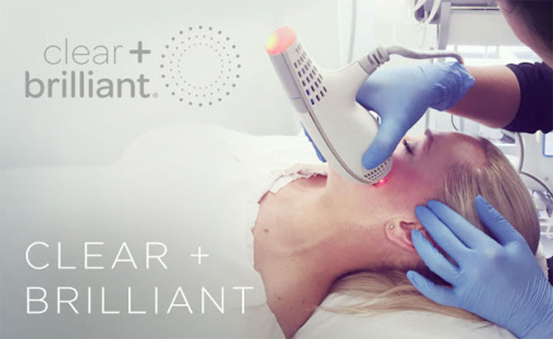 Woman receiving a Clear + Brilliant Laser Treatment