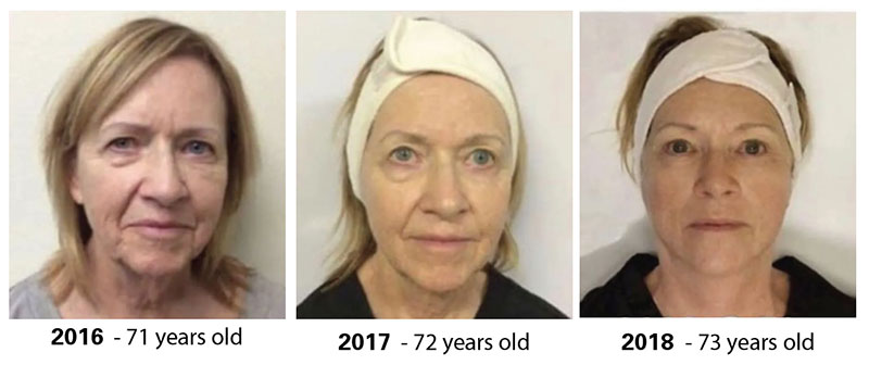 Age progression of woman's face