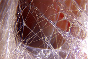 Fascia fibers