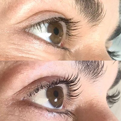 BodyLab Med Spa ©2023 – Eyelash & Eyebrow Enhancements – Eyelash Lift & Tint - Before & After Treatment